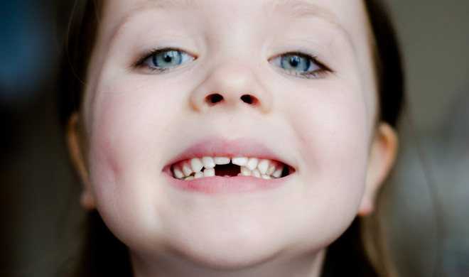 Какие молочные зубы выпадают первыми?