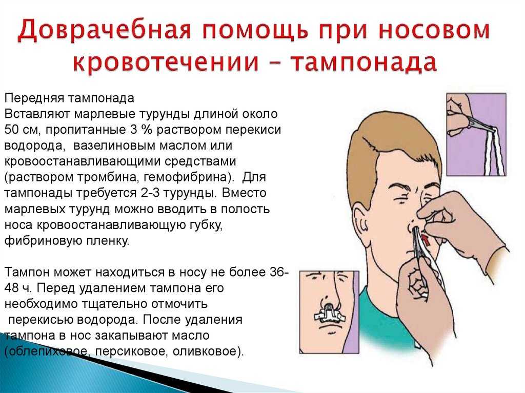Кровотечение из носа у собак  - причины и лечение эпистаксиса у собак в москве. ветеринарная клиника "зоостатус"