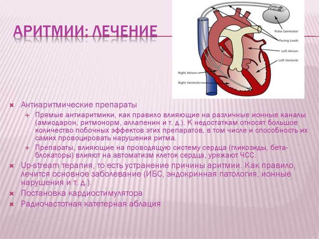Нарушения ритма (аритмии) и проводимости (блокады) сердца. диагностика и лечениеаритмия сердца. причины, диагностика и лечение сердечной аритмии