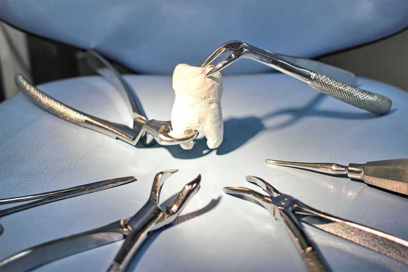 Проблемы с зубами у шиншилл: особенности строения и причины возникновения патологий