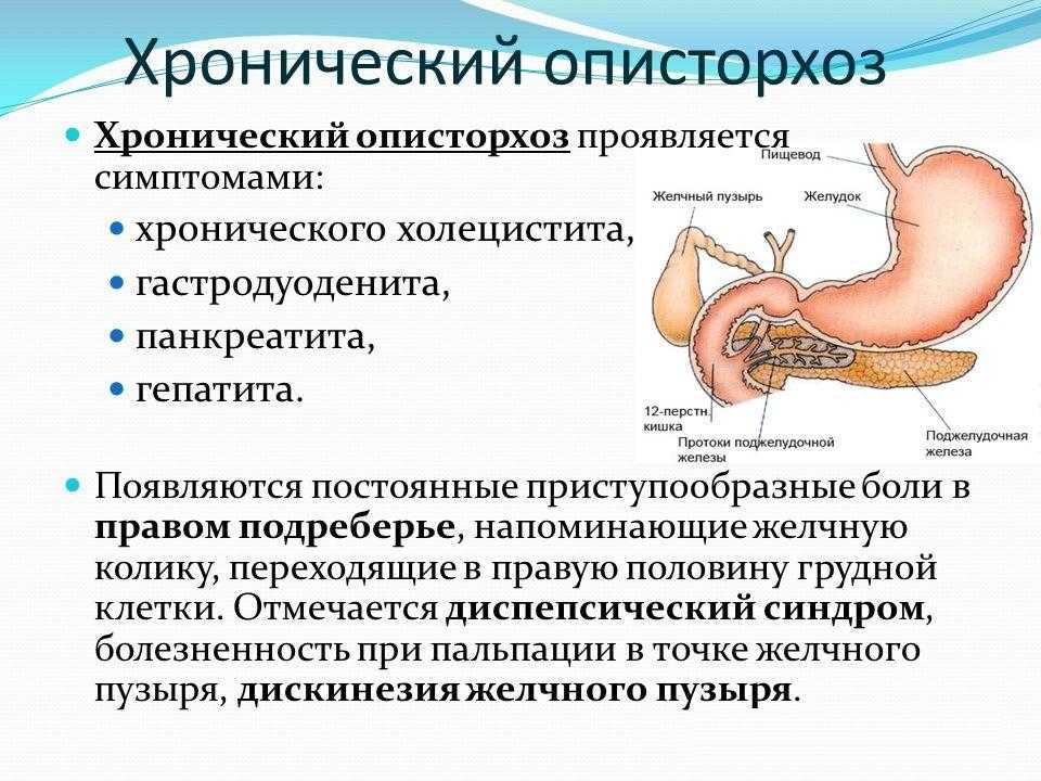 Описторхоз у кошек - довольно серьезное заболевание, которое чаще всего регистрируется из-за поедания сырой рыбы. Расскажем о симптомах и лечении описторхоза у котов