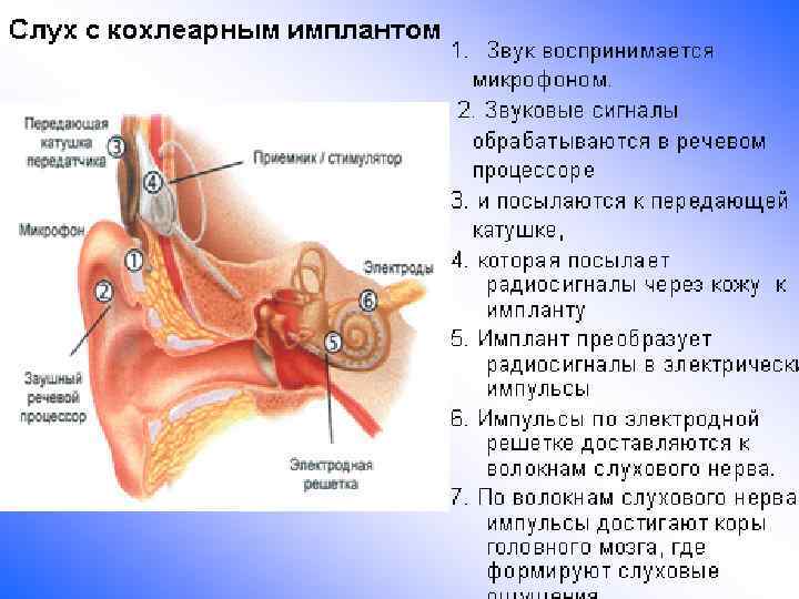 Внутреннее ухо лечение и симптомы. Список заболеваний среднего уха. Поражение среднего уха. Симптомы заболевания среднего уха. Заболевания среднего уха перечислить.