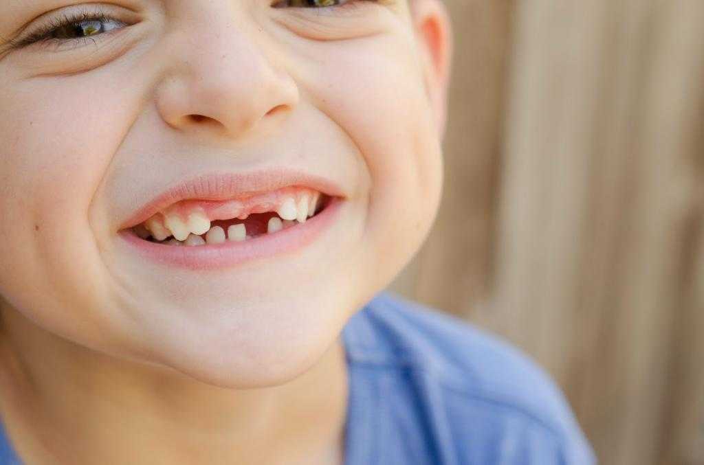 Когда и как молочные зубы смениваются постоянными