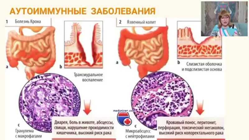 Кандидоз — причины, симптомы диагностика и лечение — спб гбуз «кожно-венерологический диспансер № 4»