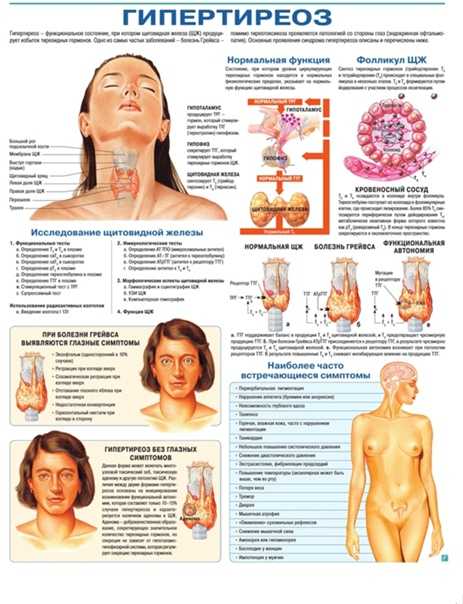 Заболевания щитовидной железы: гипотиреоз, тиреотоксикоз. симптомы, методы диагностики и лечения заболеваний щитовидки