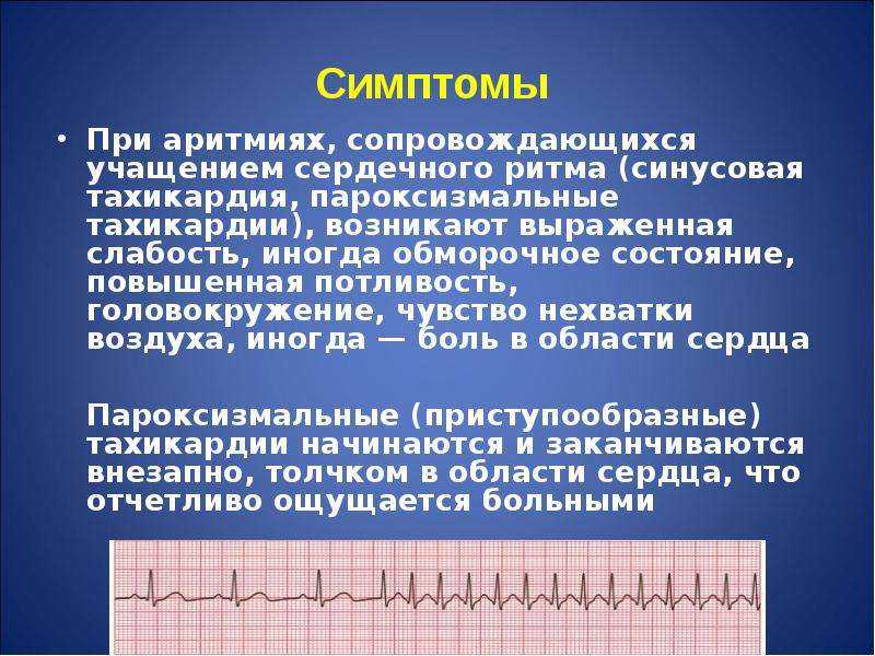 Аритмия - нарушения ритма сердца