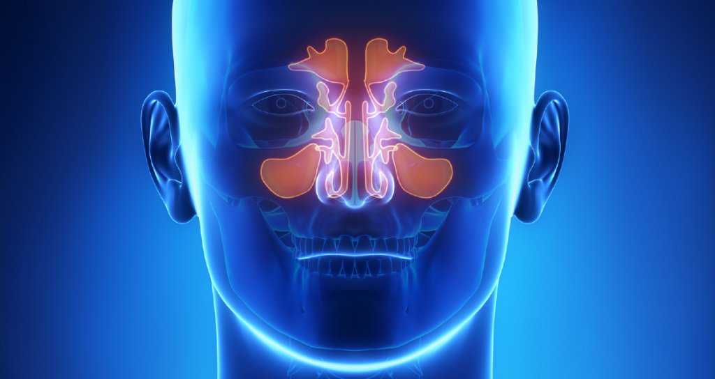 Синусит – воспаление носовых пазух. причины, симптомы, методы диагностики и лечения синусита