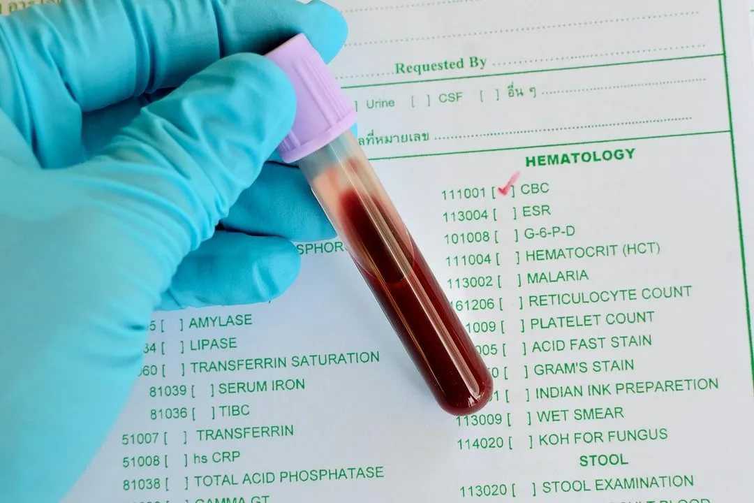 Гемоглобин в крови животных. как узнать о состоянии здоровья питомца? | животные | общество | аиф челябинск
