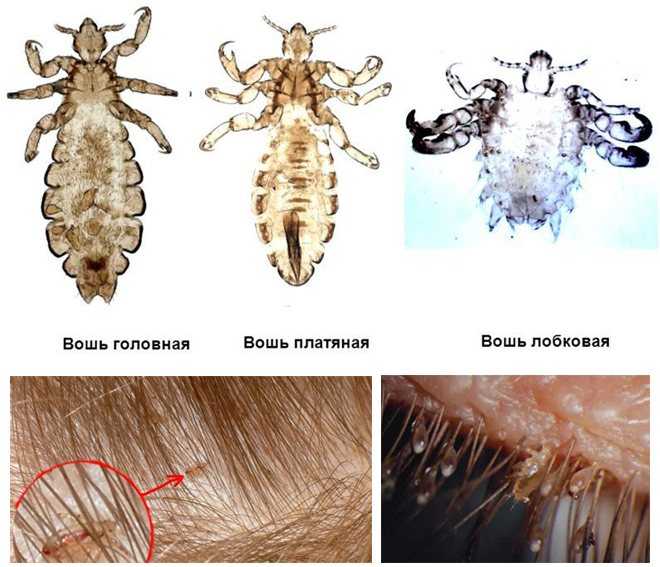 ᐉ бывают ли блохи у хомяков: как определить и чем вывести - zoopalitra-spb.ru