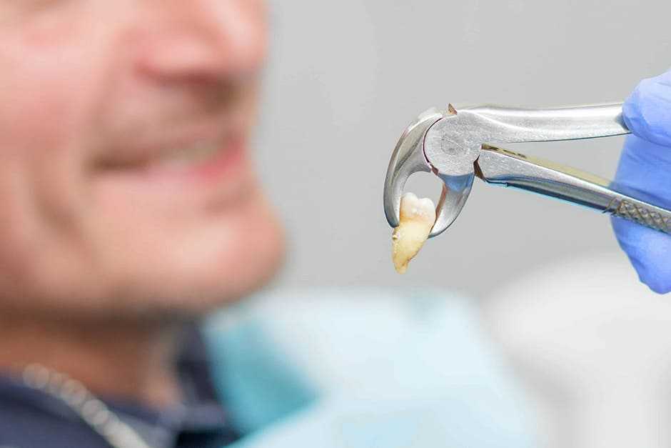 Зубы шиншиллы: особенности строения заболевания профилактик