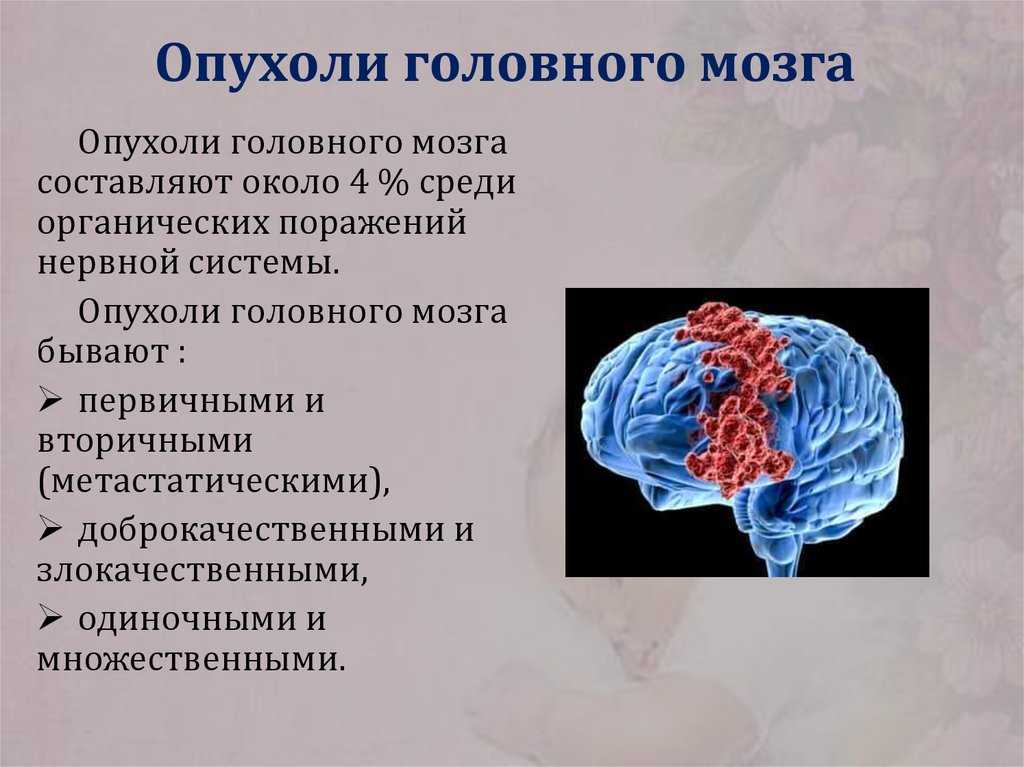 Опухоль головного мозга первый симптом
