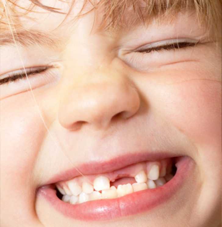 Уход за молочными зубами у детей