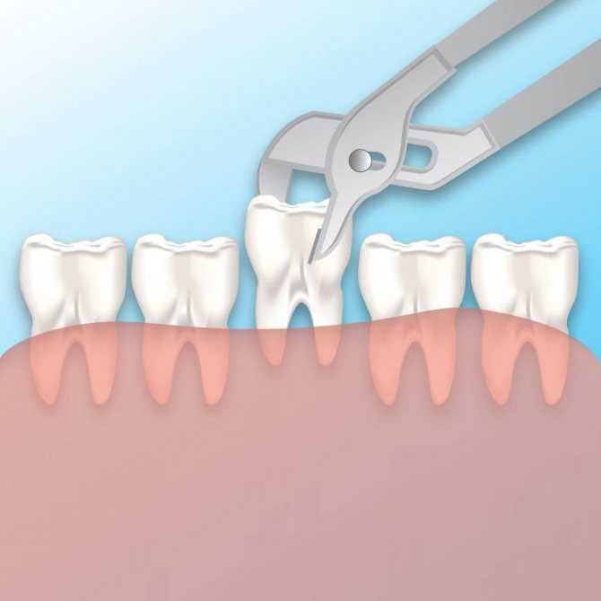 Зубы шиншиллы: особенности строения, заболевания, профилактика