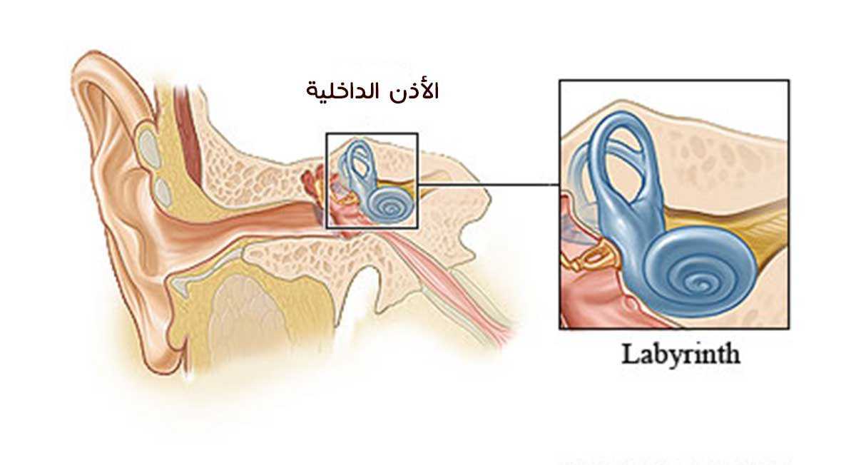 Болезнь внутреннего уха. Воспаление внутреннего уха лабиринтит. Воспаление среднего уха (лабиринтит);. Внутренний отит (лабиринтит).